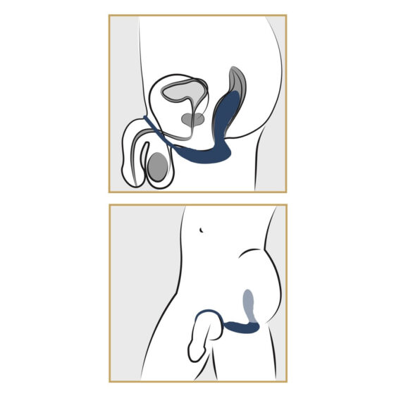 Prostata Anal Vibrator med Penisring